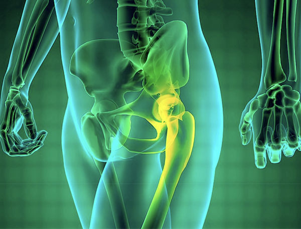 Guida alla riabilitazione per la protesi d'anca
